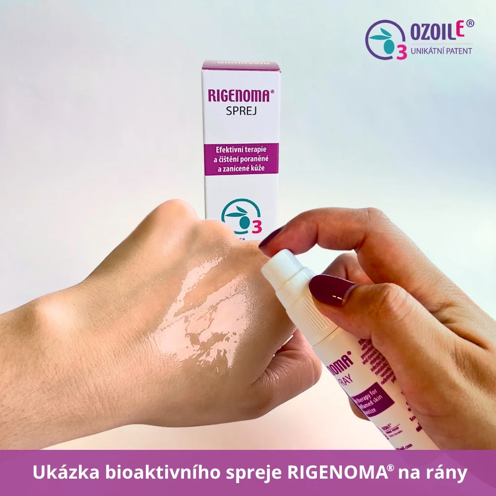 RIGENOMA bioaktivní sprej na rány s OZOILE 20 ml
