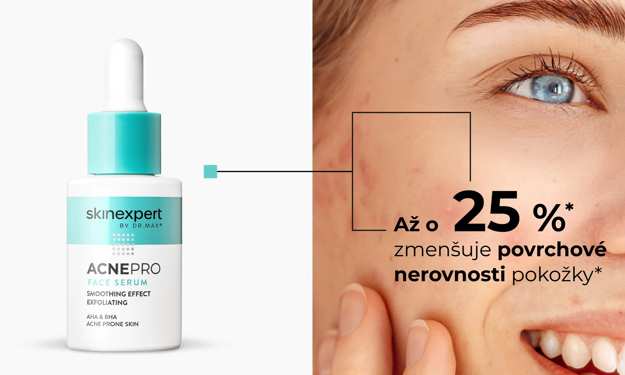 skinexpert BY DR.MAX Acnepro Face Serum 28 ml skinexpert BY DR.MAX Acnepro Face Serum 28 ml