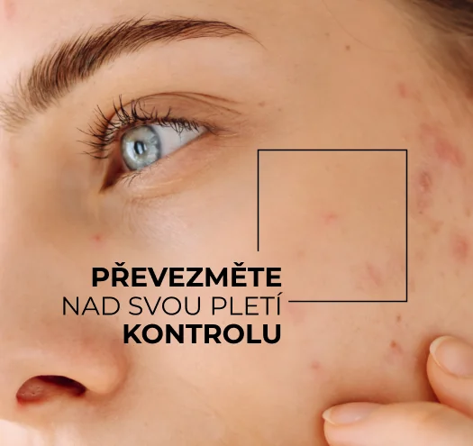 Skinexpert by Dr. Max Acnepro. Převezměte nad svou pletí kontrolu.