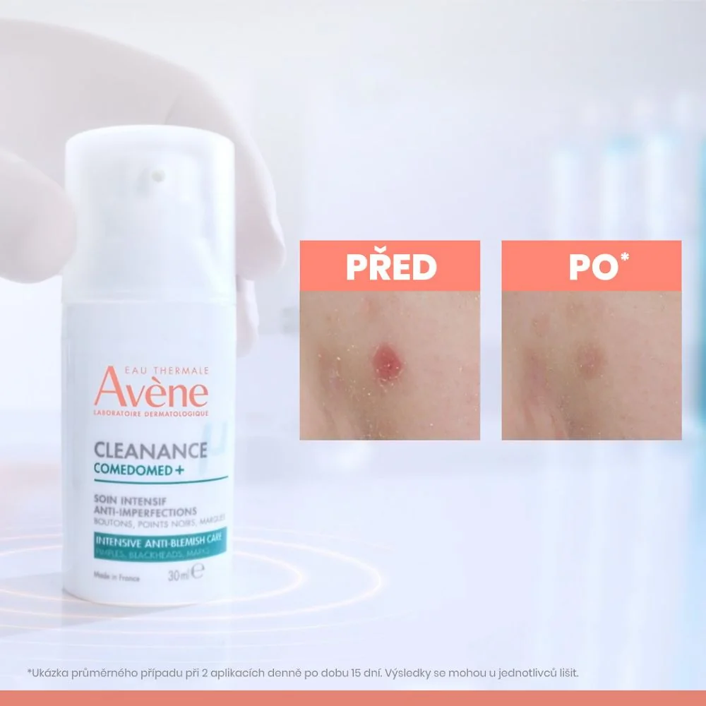 Avène Cleanance ComedoMed+ Intenzivní péče proti nedokonalostem pleti 30 ml