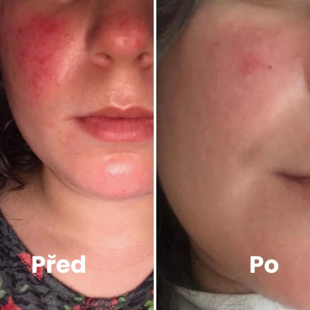 Renovality Moringový olej lisovaný za studena 100 ml