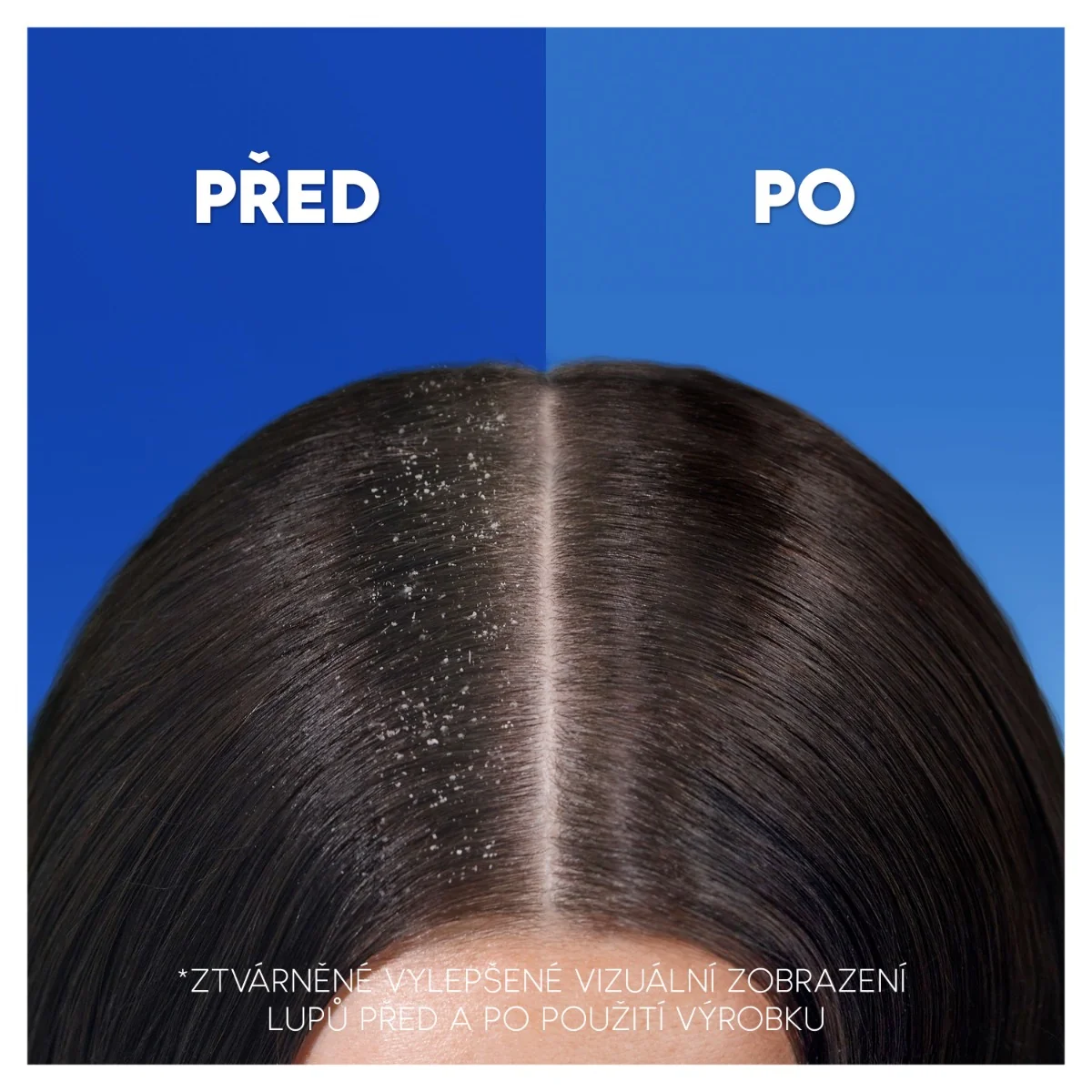 Head&Shoulders Anti-Hair Fall šampon proti lupům 400 ml