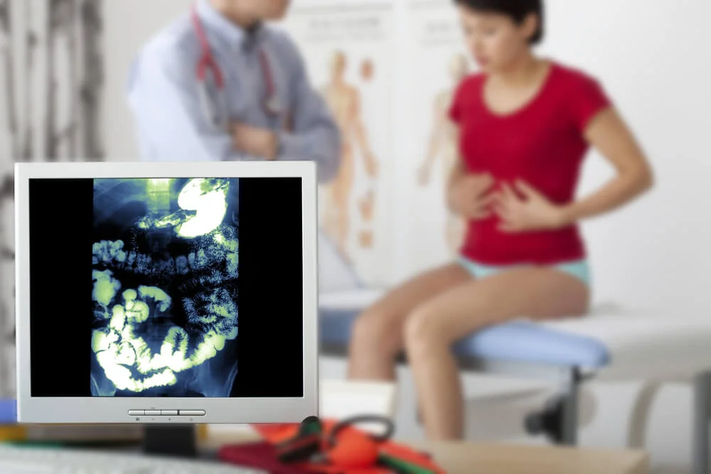Jaká vyšetření stanoví diagnózu ulcerózní kolitidu? Jaká vyšetření stanoví diagnózu ulcerózní kolitidu?