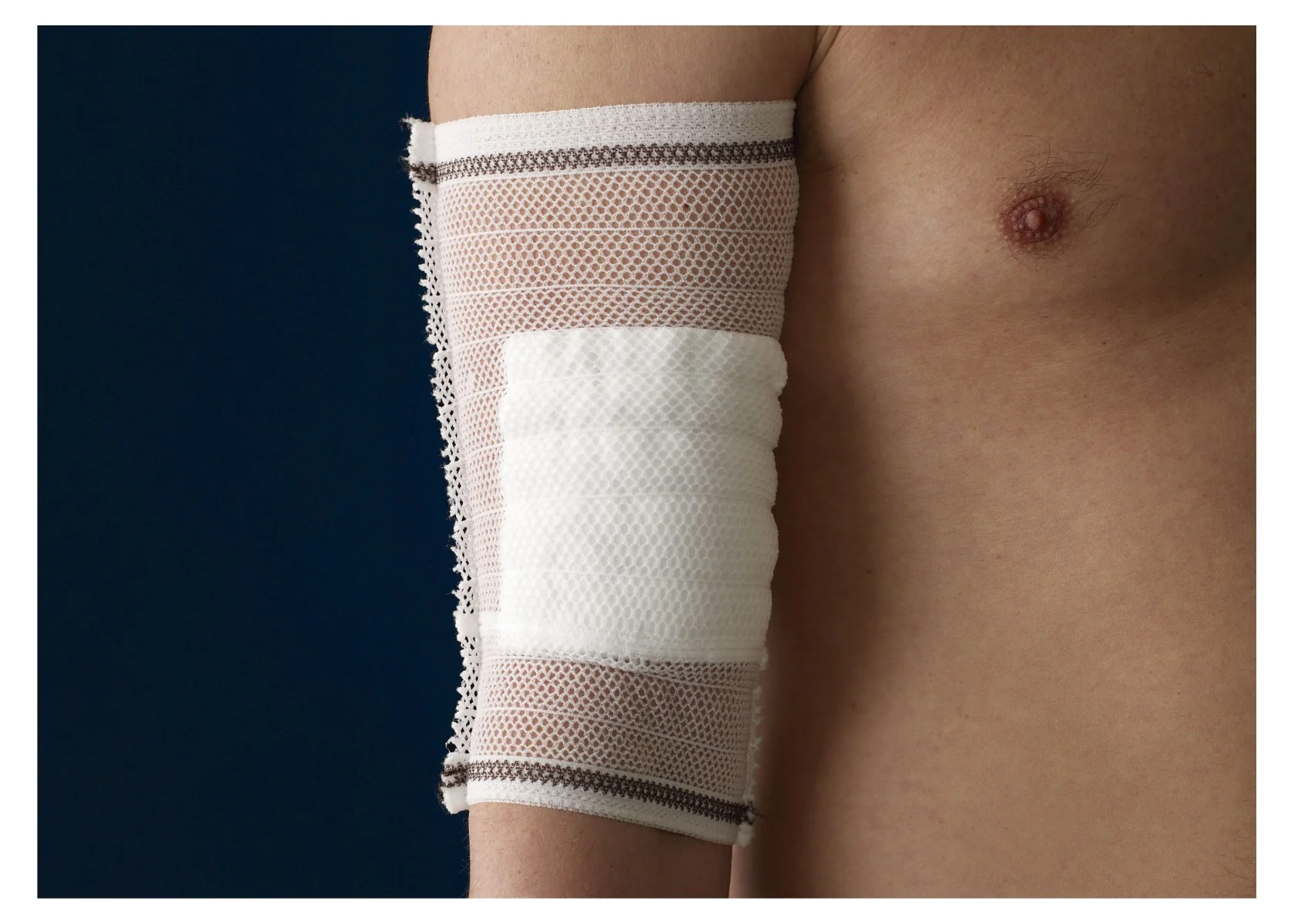 CareFix Tube vel. XL elastický síťový obvaz 15 ks