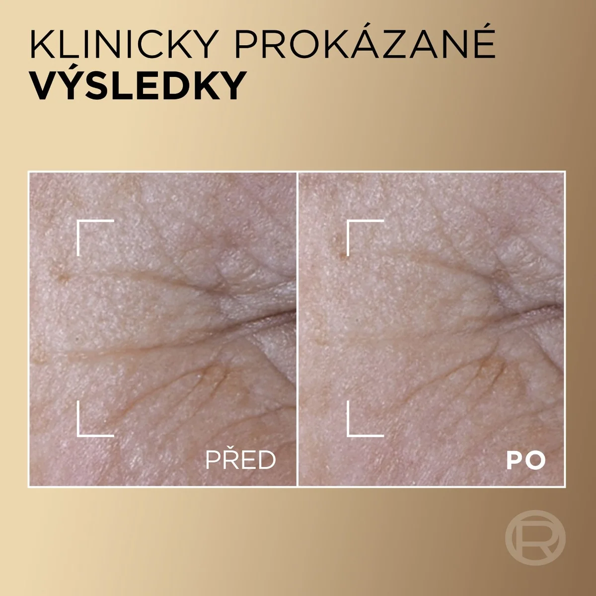 Loréal Paris Age Perfect Le Duo omlazující sérum 30 ml
