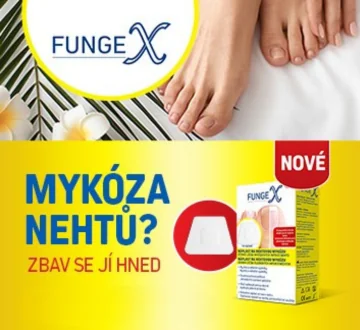Mykóza nehtů? Zbav se jí hned. Fungex. Mykóza nehtů? Zbav se jí hned. Fungex.