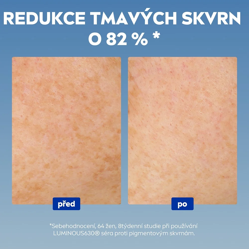 Nivea Cellular Luminous sérum proti pigmentovým skvrnám 30 ml