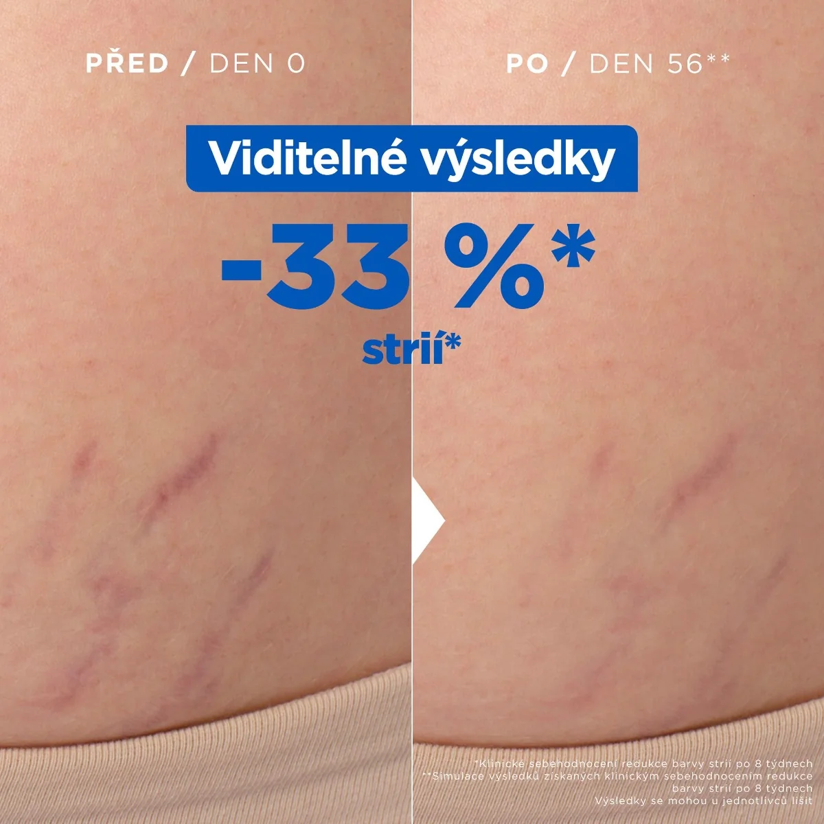 Mixa Olej proti striím 100 ml