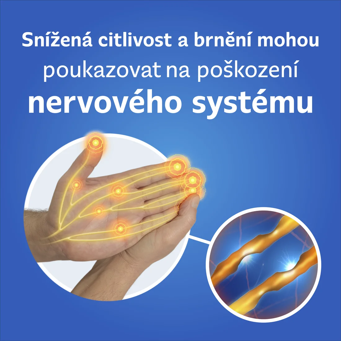 Neurobion 100 mg/50 mg/1 mg 30 tablet