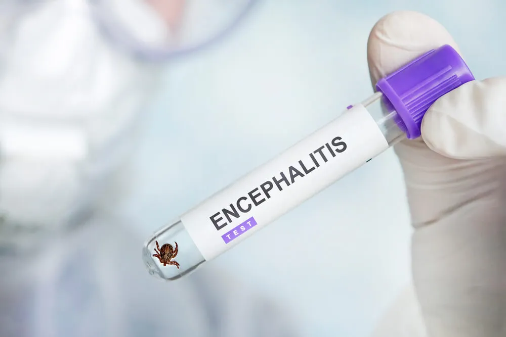 Klíšťová encefalitida – příznaky, léčba a očkování