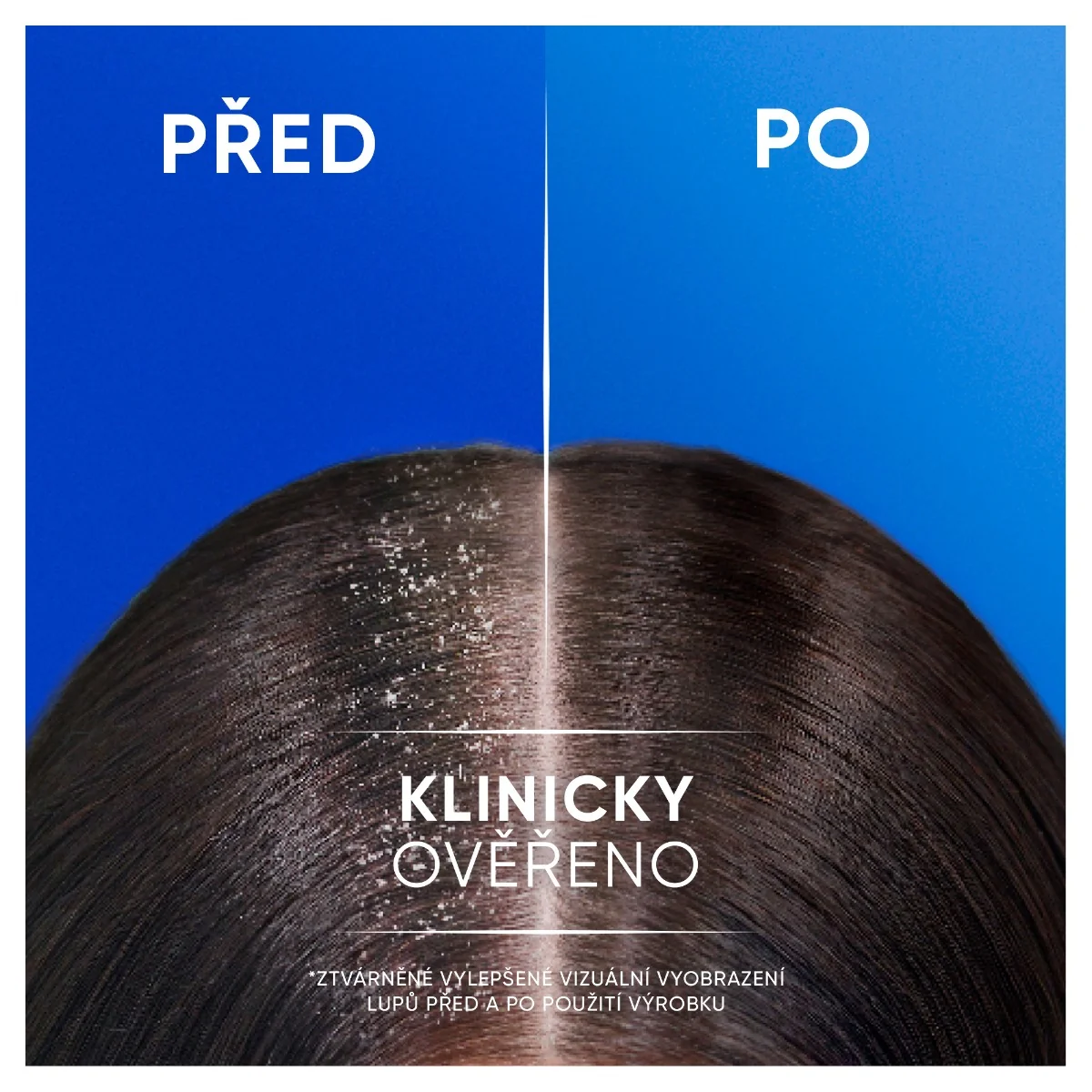Head&Shoulders Anti-hairfall with Classic 2v1 šampon a kondicionér proti lupům 400 ml