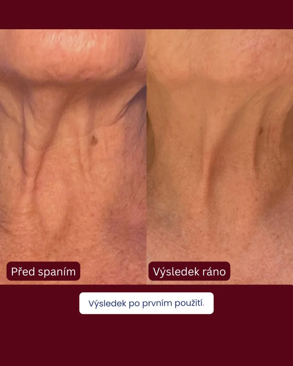Naydaya Silikonová náplast proti vráskám na krk 1 ks