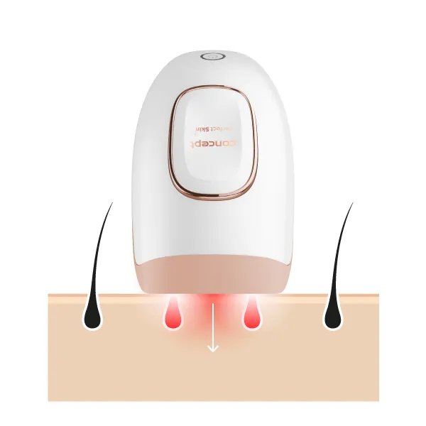 Concept Perfect Skin IL3000 IPL epilátor