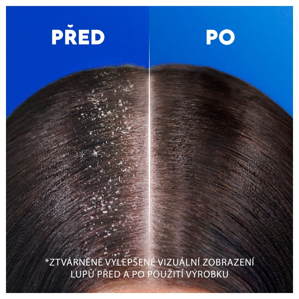 Head&Shoulders Menthol šampon proti lupům 800 ml