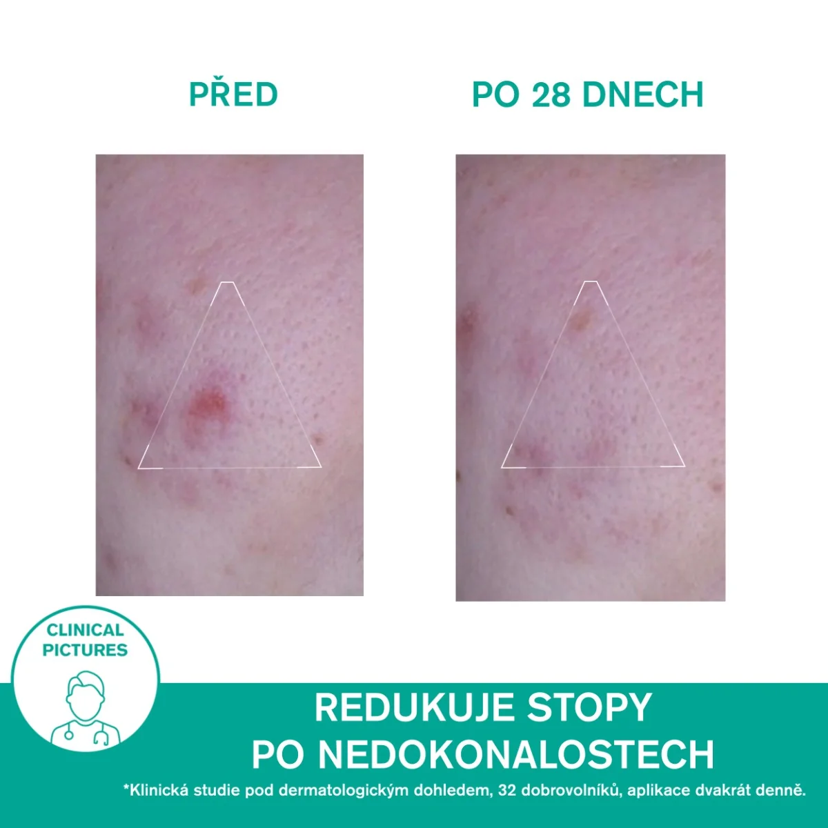Uriage Hyséac 3-Regul+ Komplexní péče proti nedokonalostem 40 ml
