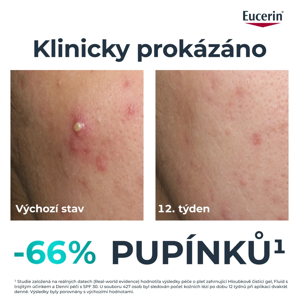 Eucerin DermoPure Clinical Fluid s trojitým účinkem 40 ml