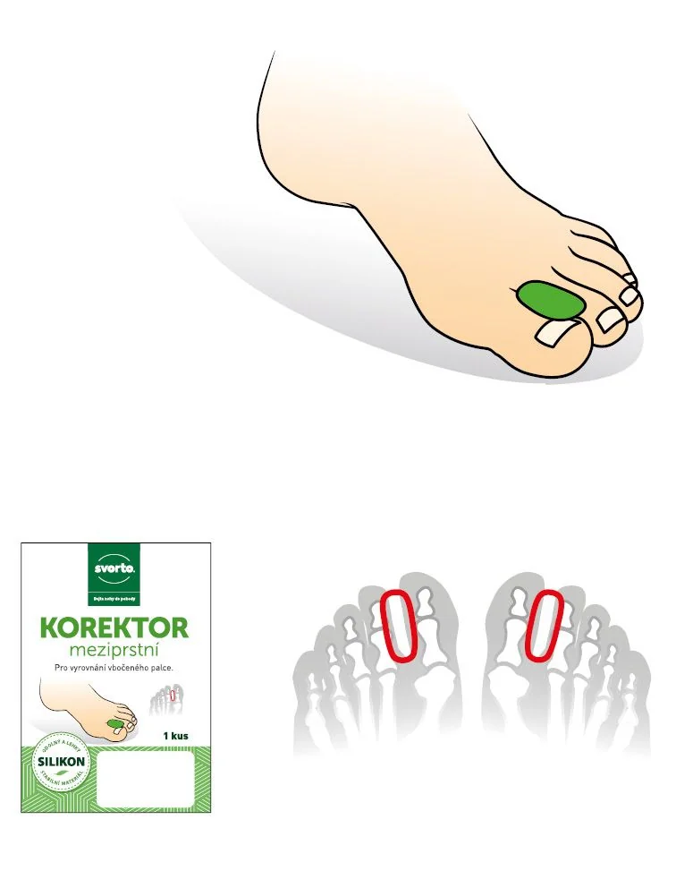 Svorto 049 Korektor meziprstní vel. 37-41 1 ks