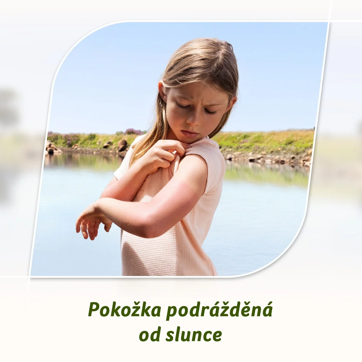 Fenistil FeniNatural chladivý krém 30 ml