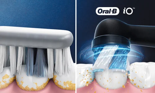 Oral-B iO 2 elektrický zubní kartáček černý - o 100 % čistější zuby a prokázaná ochrana dásní Oral-B iO 2 elektrický zubní kartáček černý - o 100 % čistější zuby a prokázaná ochrana dásní