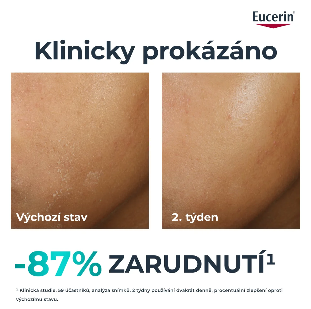 Eucerin DermoPure Clinical Obnovující krém 40 ml
