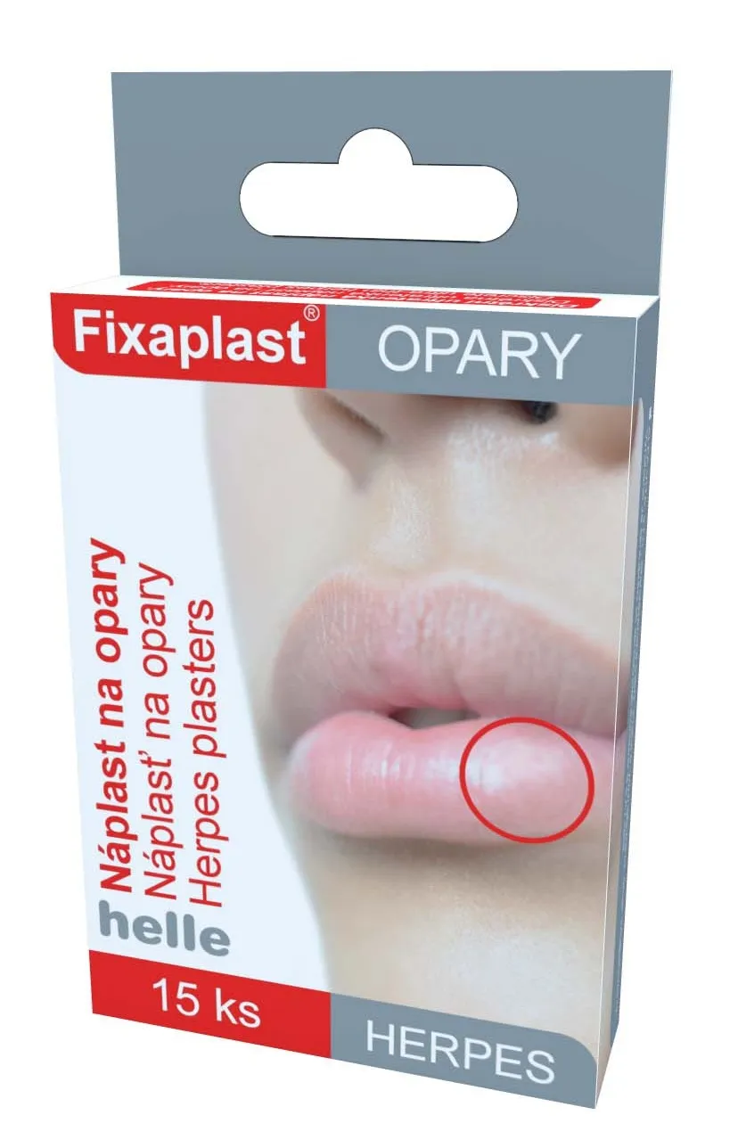 N plasti Na Opary n-plasti-na-opary