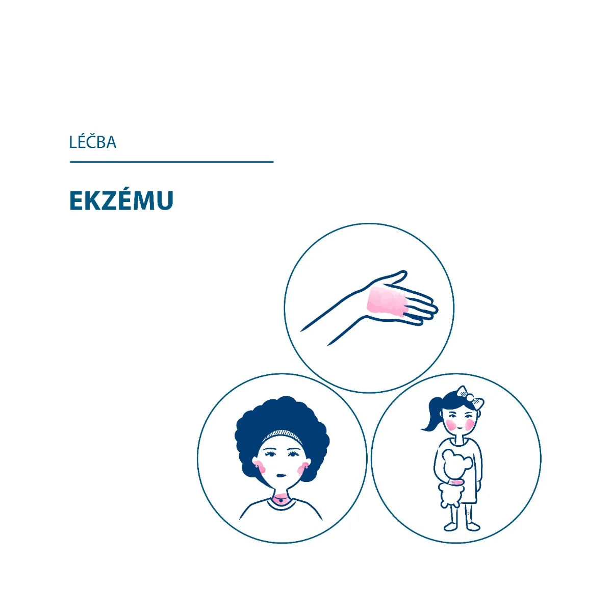 Ducray DEXYANE MeD Zklidňující krém 100 ml