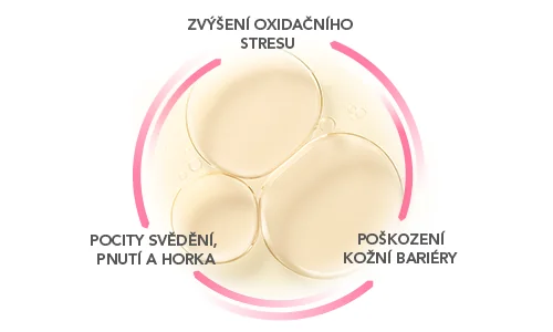 Začarovaný kruh citlivé pleti – vystupte z něj s BIODERMA Sensibio micelárním olejem Začarovaný kruh citlivé pleti – vystupte z něj s BIODERMA Sensibio micelárním olejem