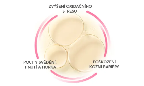 Začarovaný kruh citlivé pleti – vystupte z něj s BIODERMA Sensibio micelárním olejem