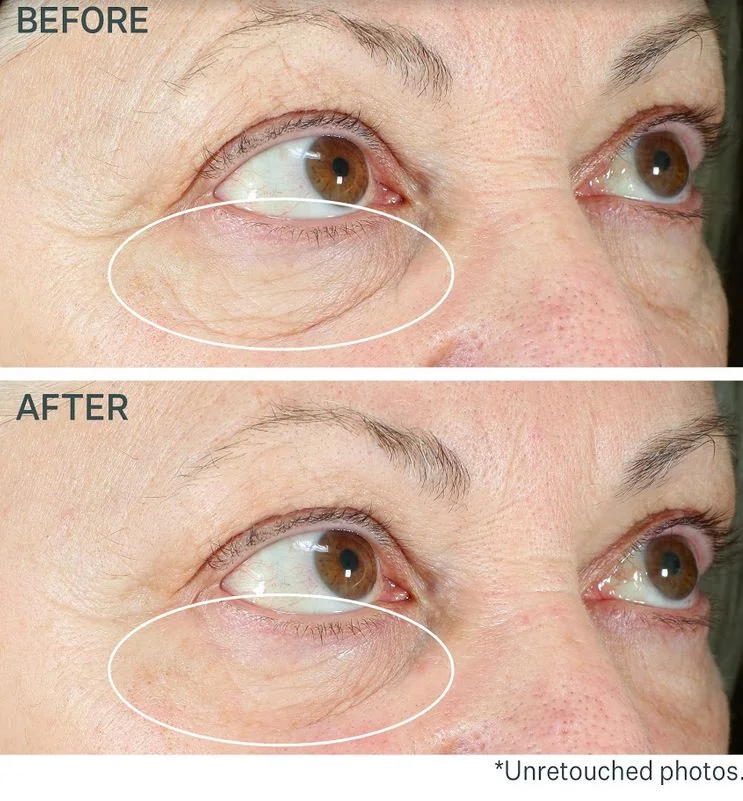 StriVectin TL Hyperlift Eye Instant Eye Fix krém na oční vaky 10 ml