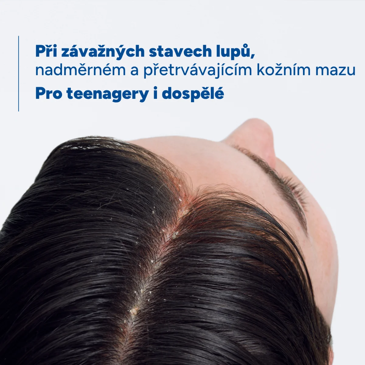 Ducray Kelual DS Sebocontrol šampon proti lupům 100 ml