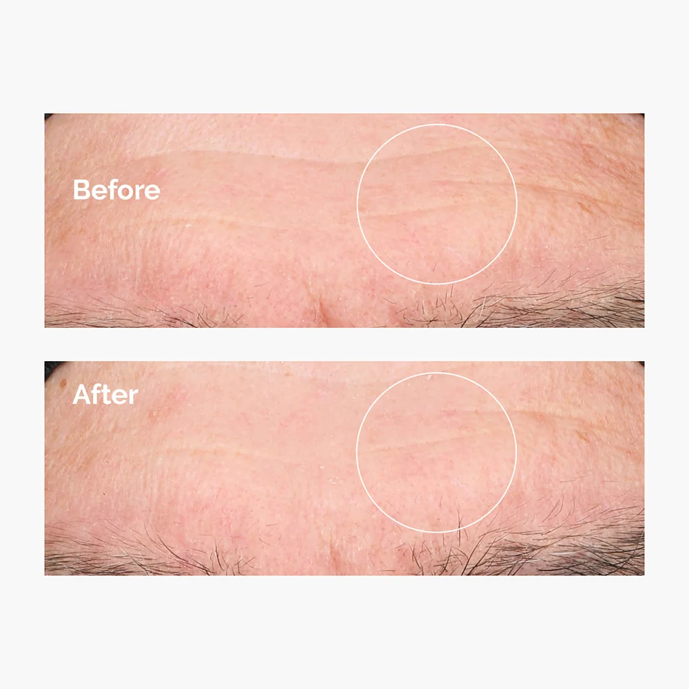 The Ordinary Hyaluronic Acid 2% B5 hydratační sérum 60 ml