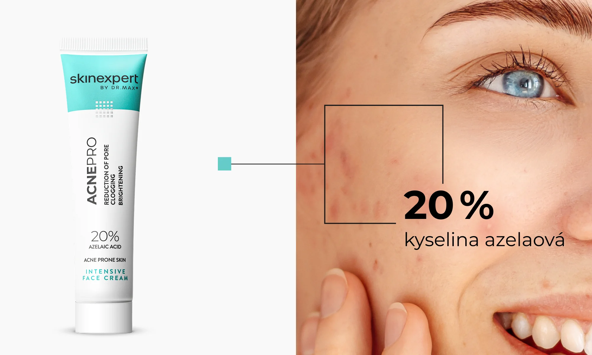 skinexpert BY DR.MAX Acnepro Intensive Face Cream 30 g skinexpert BY DR.MAX Acnepro Intensive Face Cream 30 g
