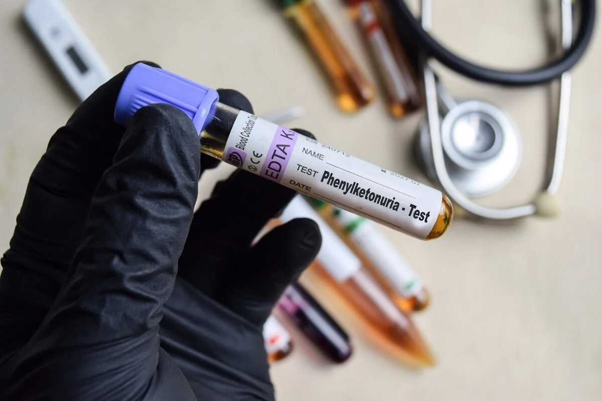 Fenylketonurie – příznaky, diagnostika a léčba