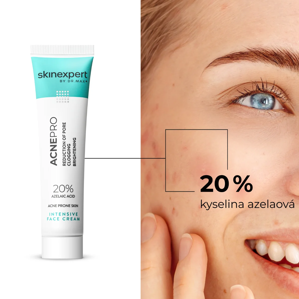 skinexpert BY DR.MAX Acnepro Intensive Face Cream 30 g