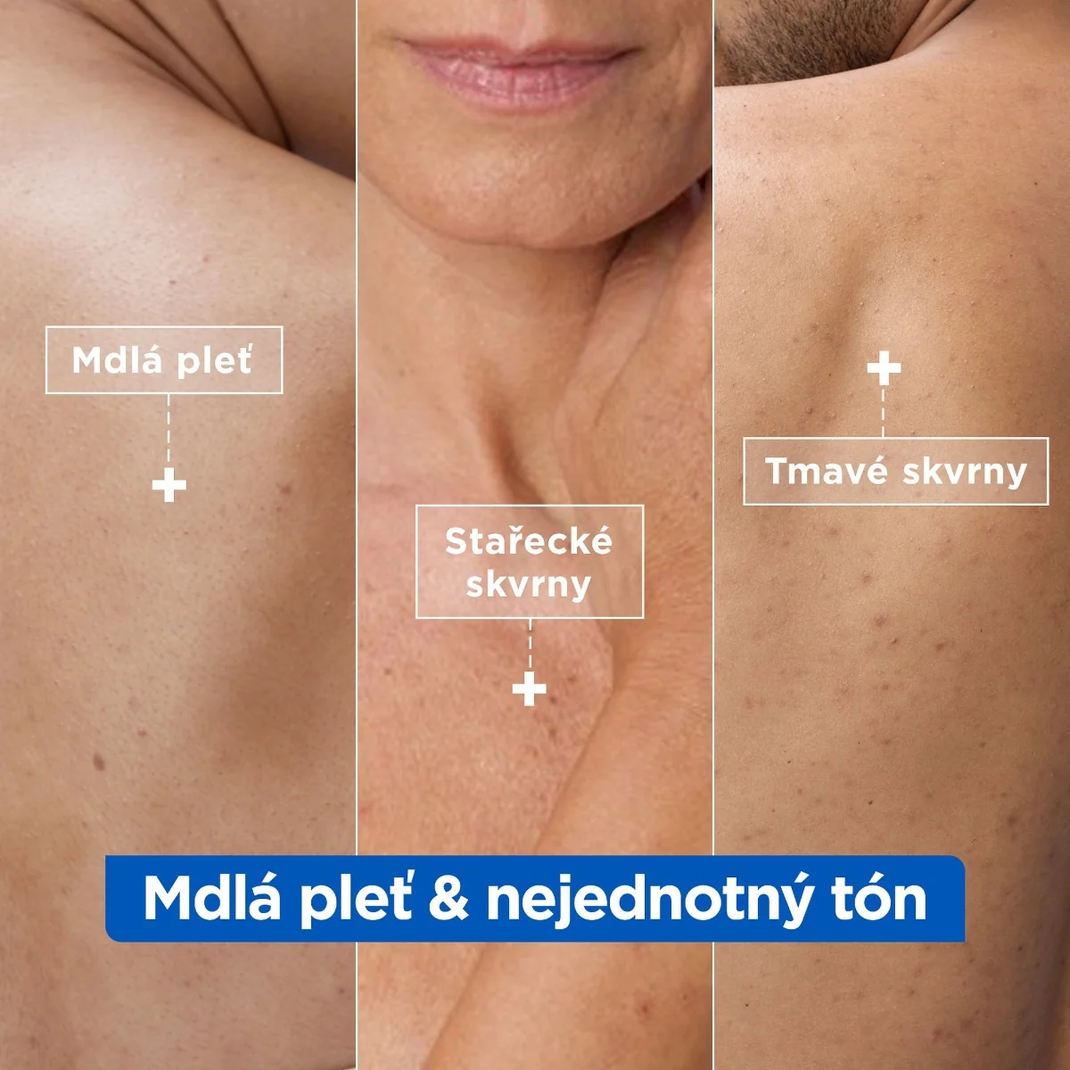 Mixa Niacinamide Bright Hydratační krém proti tmavým skvrnám 400 ml