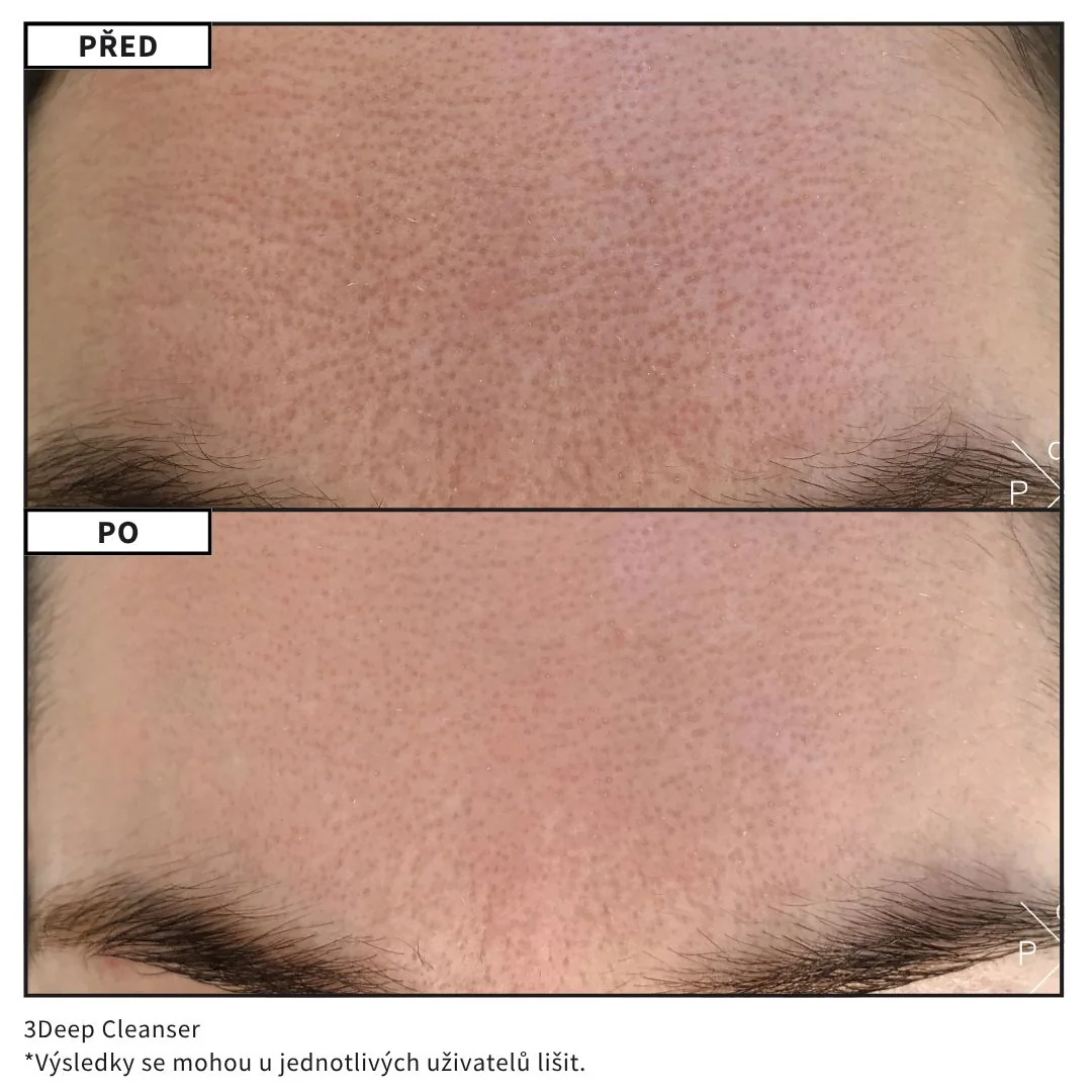 Dr. LEVY Čisticí gel, exfoliace a maska 3v1 150 ml