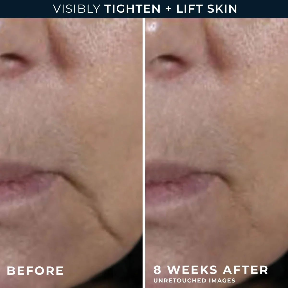 RoC Multi Correxion Firm + Lift Rich zpevňující krém 50 ml