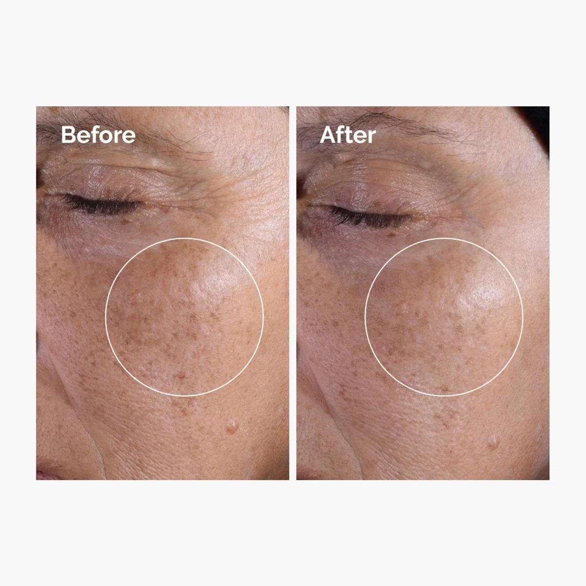 The Ordinary Glycolic Acid 7% Exfoliating Toner exfoliační čisticí tonikum 240 ml