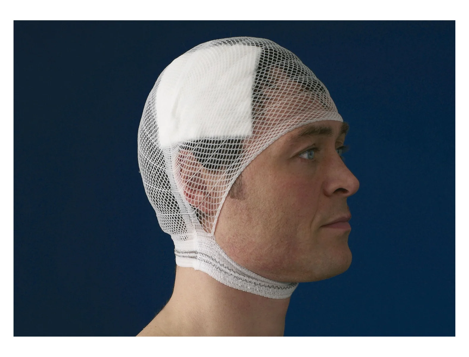 CareFix Head vel. XL elastický síťový obvaz 10 ks