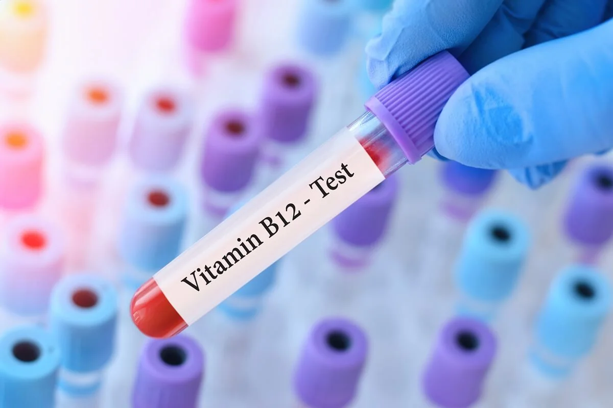 Diagnostika nedostatku vitaminu B12