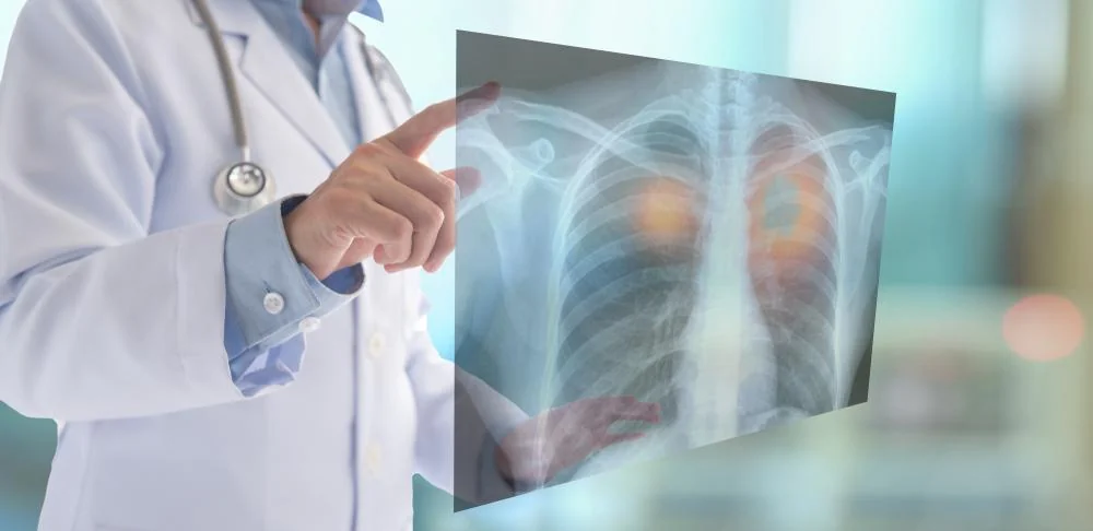Plíce a postcovidový syndrom: Jak se dostat zpět do formy?