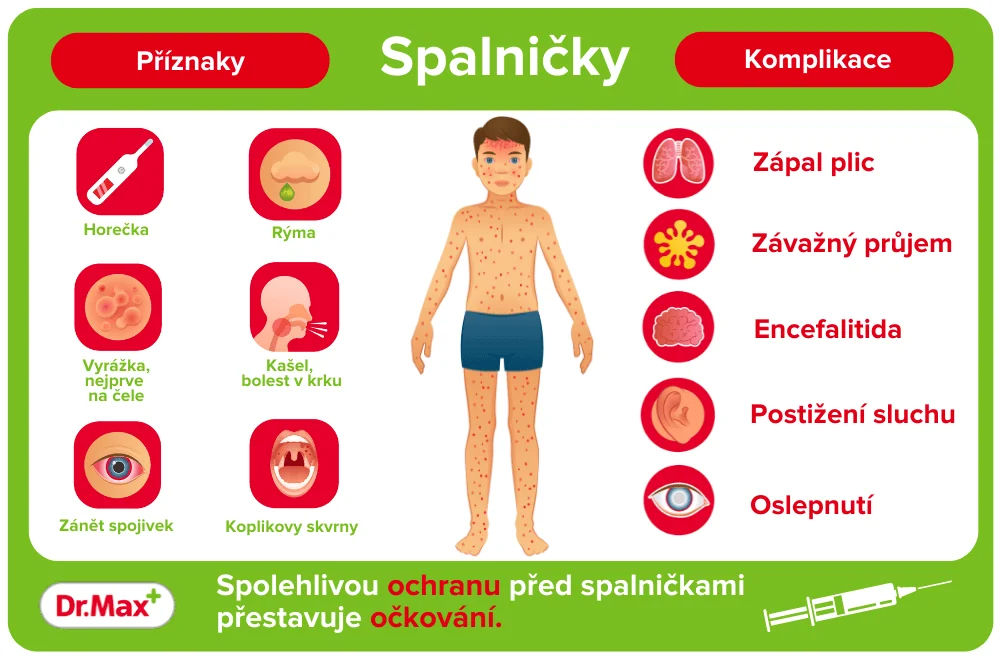 Spalničky – příznaky a komplikace