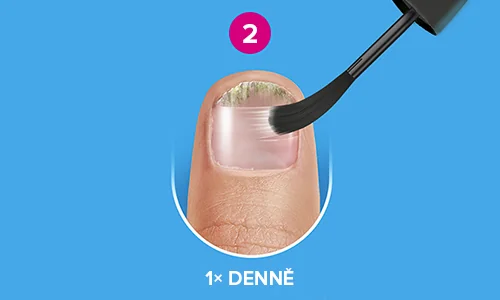 Jak přípravek Excilor® Forte aplikovat? Krok 2 Jak přípravek Excilor® Forte aplikovat? Krok 2