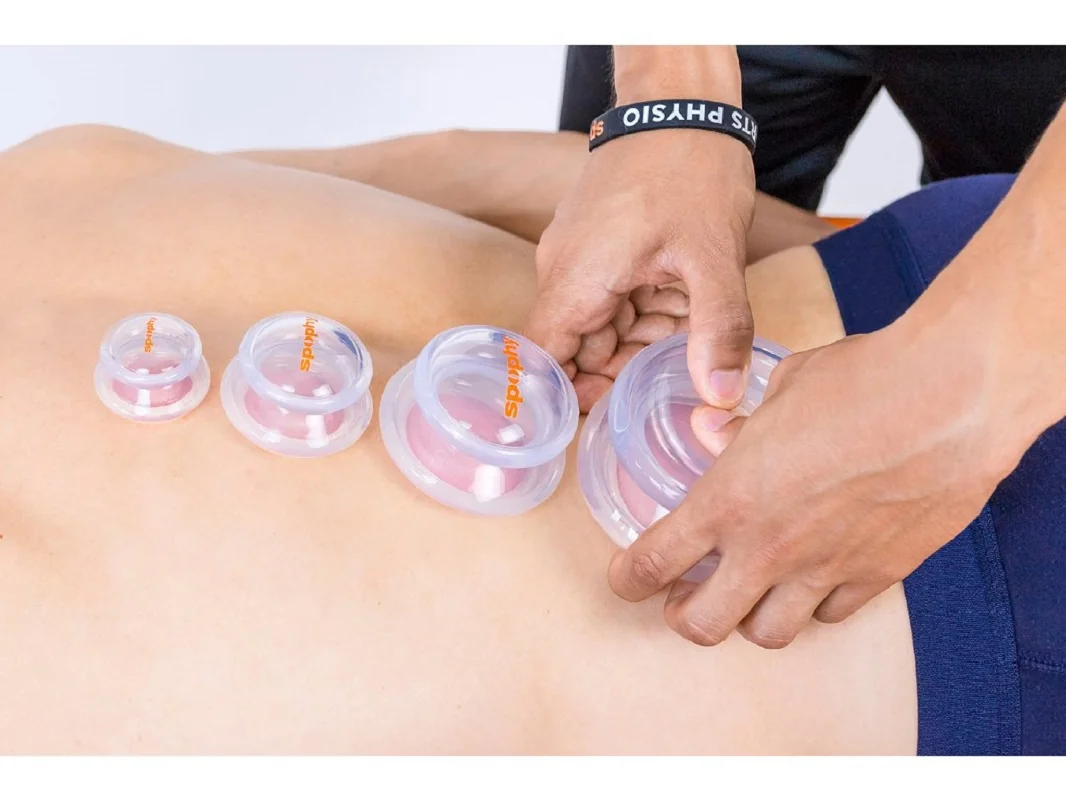 Spophy Cupping Set, sada silikonových baněk