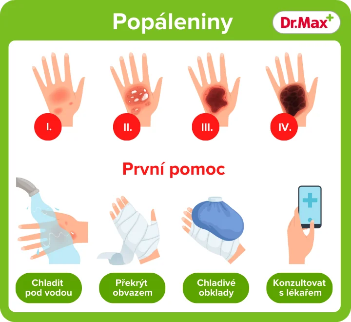 První pomoc při popáleninách První pomoc při popáleninách