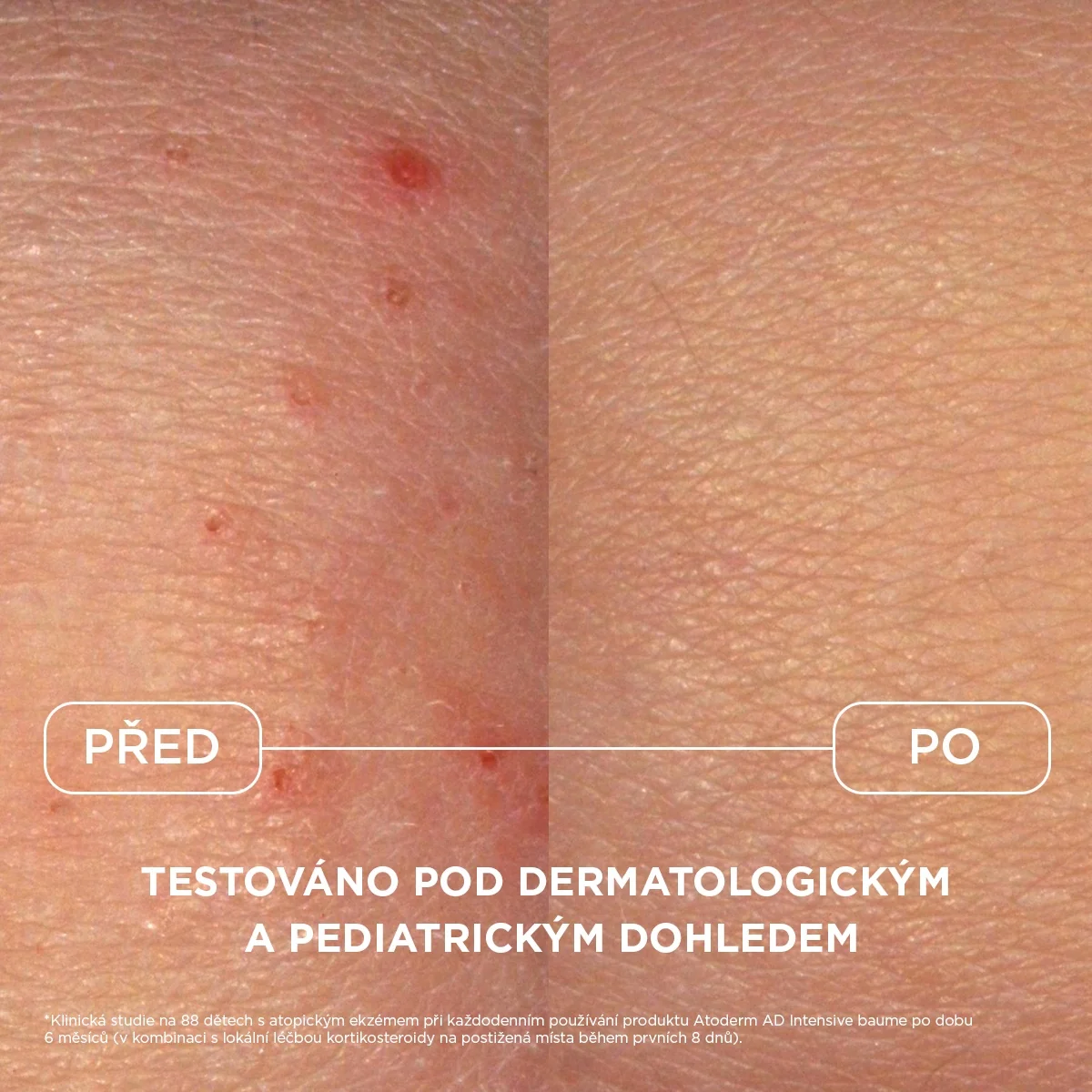 BIODERMA Atoderm AD Intensive baume zklidňující balzám 200 ml
