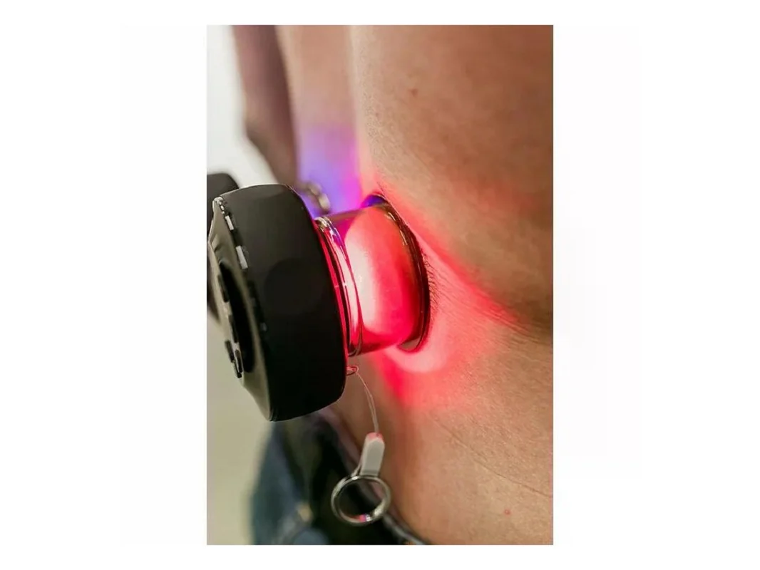 AERIFY CUPPER, chytrá masážní baňka 