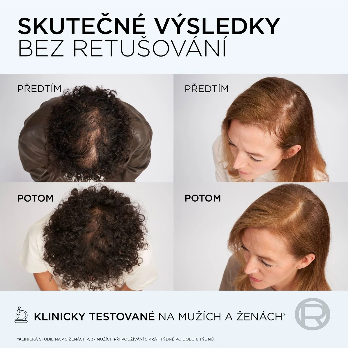 Loréal Paris Elseve Growth Booster sérum při vypadávání vlasů 102 ml