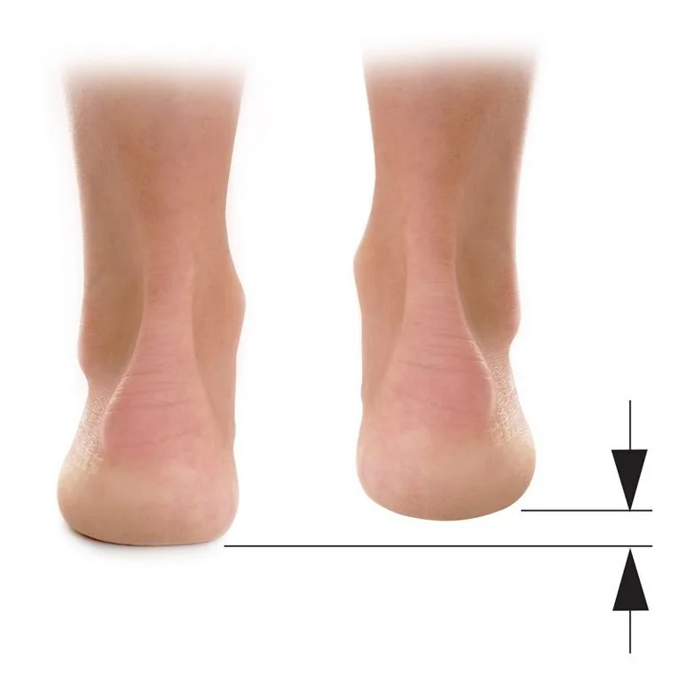 Svorto 017/a Podpatěnka korekční 0,5 cm 40-42 1 ks