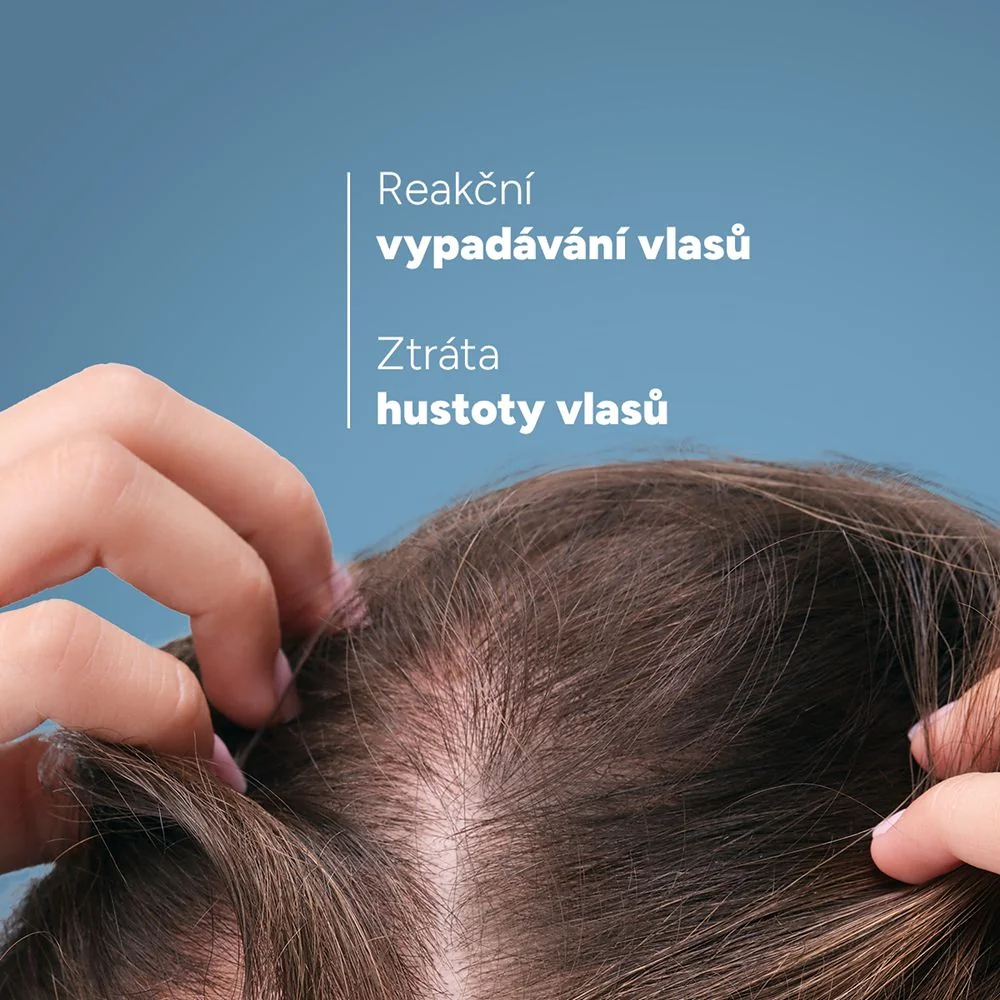 Ducray Creastim Reactiv Roztok proti vypadávání vlasů 2měsíční kúra 60 ml